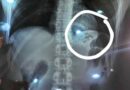 Homem engole drogas para fugir da Guarda