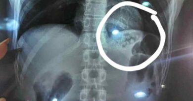 Homem engole drogas para fugir da Guarda