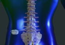 SUS incorpora estimulação medular ao tratamento da dor crônica